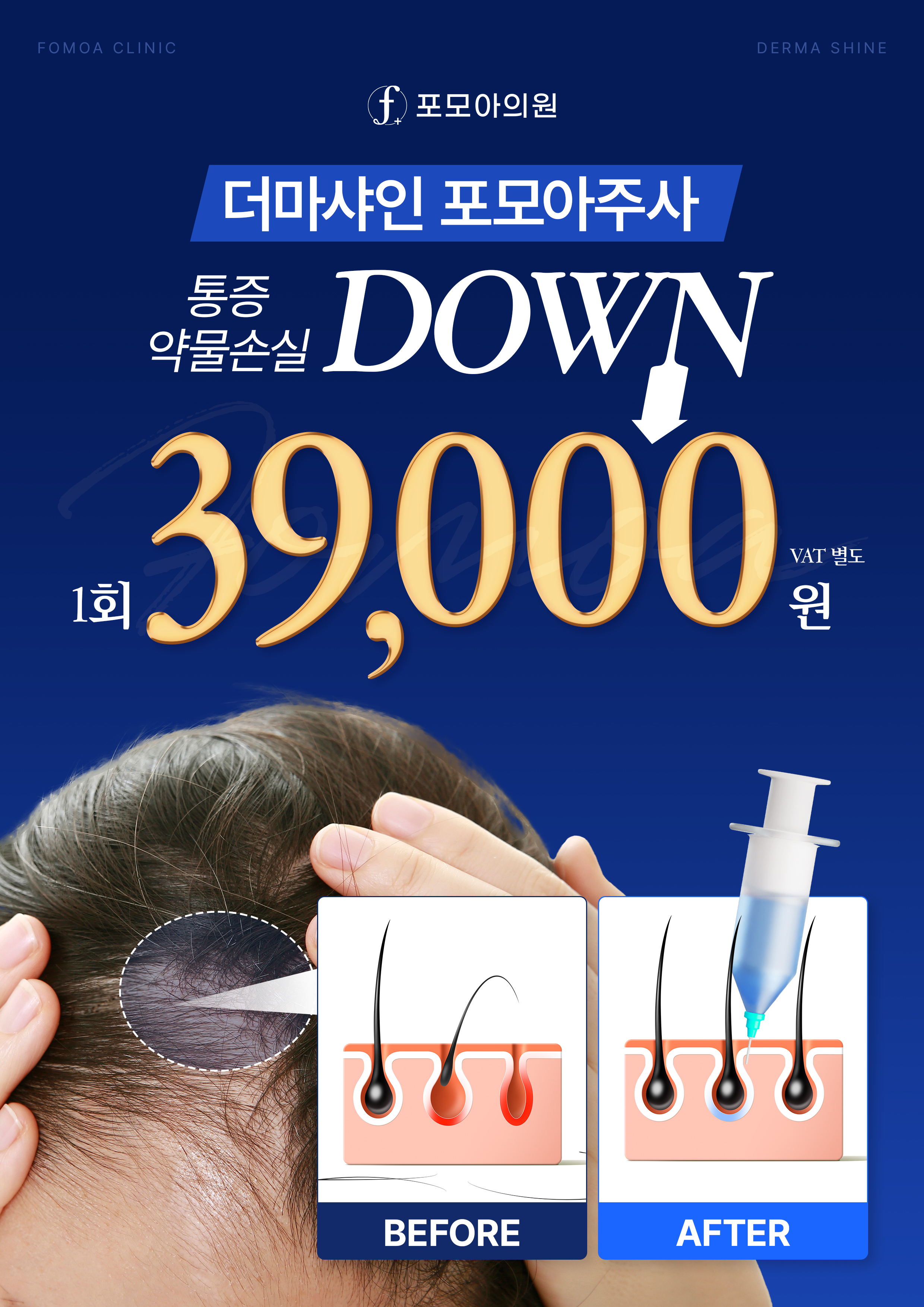 포모아이벤트
